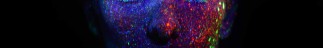 blog-detail-01